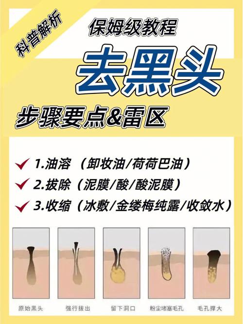 2024年6月美容院护肤去黑头流程,美容院护肤去黑头流程表