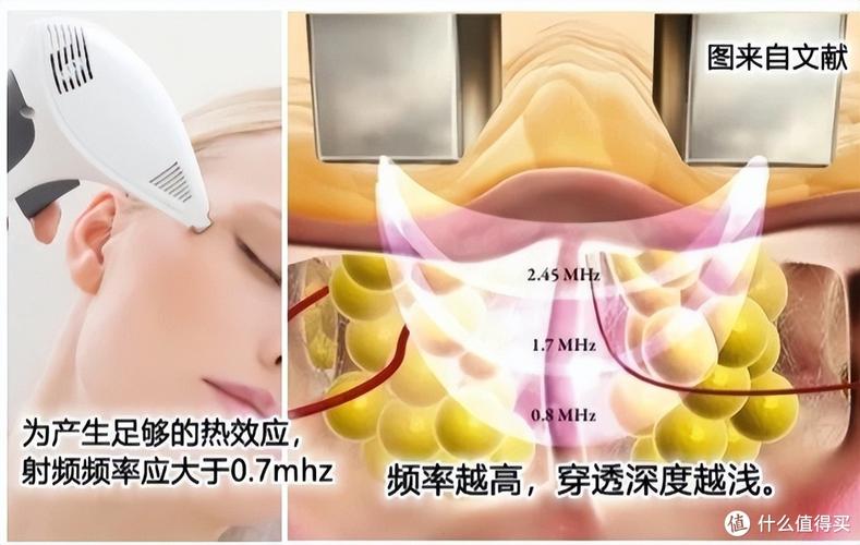 2024年6月怎样选射频美容仪器的功效,射频美容仪器怎么样